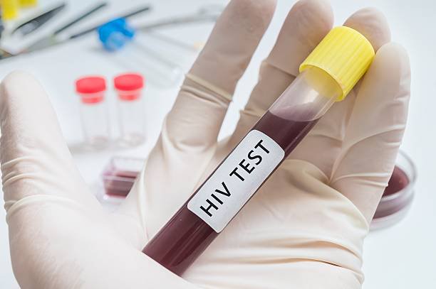 HIV test nhanh - Xét nghiệm Dr.Labo